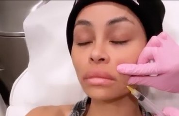 Blac Chyna shocks fans by posting video of her agonising SIXTH facial filler dissolving op