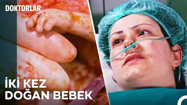 Aynı Bedende İki Kez Dünyaya Gelen Bebek - Doktorlar