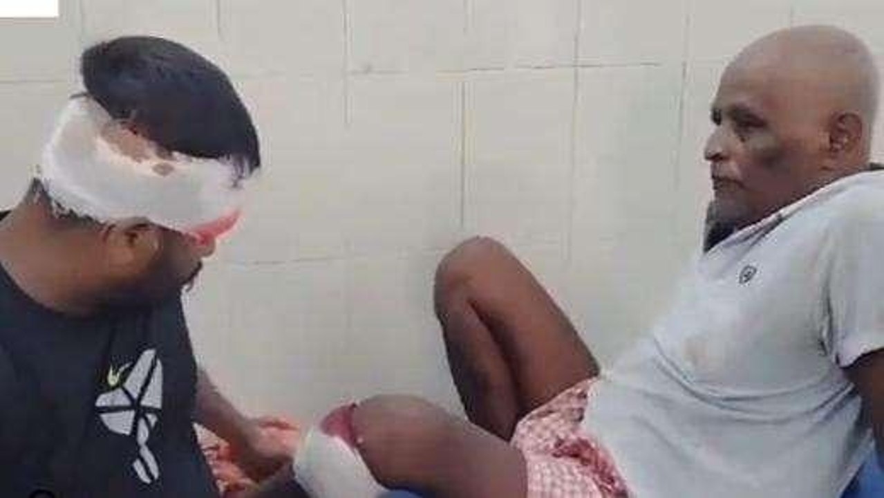 समस्तीपुर: रास्ते के विवाद को लेकर दो पक्षों में मारपीट, महिला सहित चार लोग जख्मी
