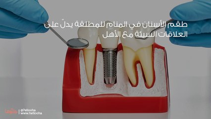 رؤية طقم الأسنان في المنام للمطلقة