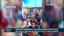 Keluarga Siswa SPN yang Tewas Bawa Foto Bukti Dugaan Kekerasan ke Polisi