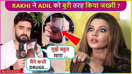 Mere Parivaar Ko Pareshaan.. Adil Khan Durrani On Rakhi Beating Him, Sherlyn's Support, Family & More