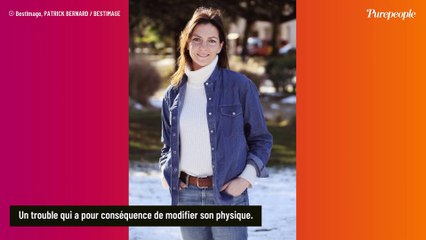 Download Video: Carole Bianic (Demain nous appartient), son physique changé par un trouble : la maladie progresse, une photo dévoilée