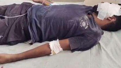 भीलवाड़ा: सड़क निर्माण कार्य के चलते रोड पर गिट्टी होने पर फिसली बाइक और फिर