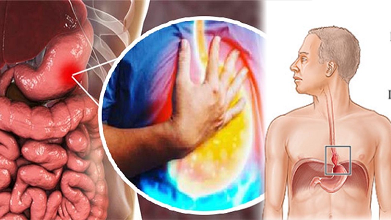 Khana Khane Ke Bad Pet Me Jalan Hona | खाना खाने के बाद पेट में जलन क्यों होती है | Boldsky