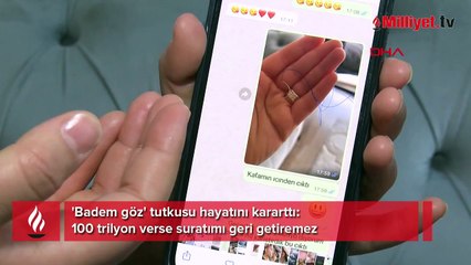 'Badem göz' tutkusu hayatını kararttı: 100 trilyon verse suratımı geri getiremez