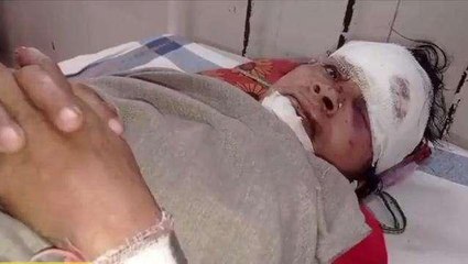 गाडरवारा: भीषण टक्कर में महिला घायल,गंभीर हालत में अस्पताल में भर्ती