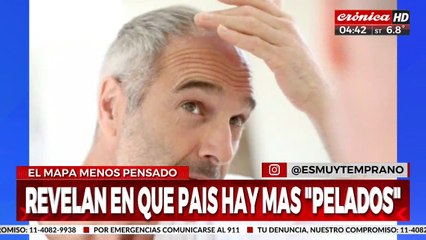 ¿Cuáles son los países con más pelados en el mundo?