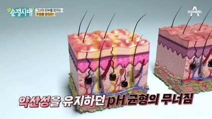 나도 혹시 수.부.지? 수분 부족형 지성 피부 알아보기!