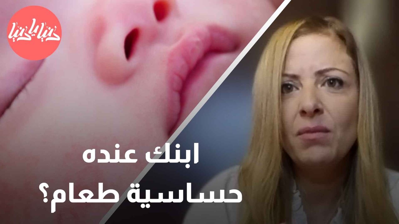 كيف يمكن أن تكون الحساسية عند الأطفال بداية لسلسلة من الحساسيات الأخرى؟