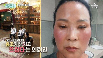 블로그 따라 하다 망가진 피부! 의뢰인 전성옥 씨의 수상한 피부 관리