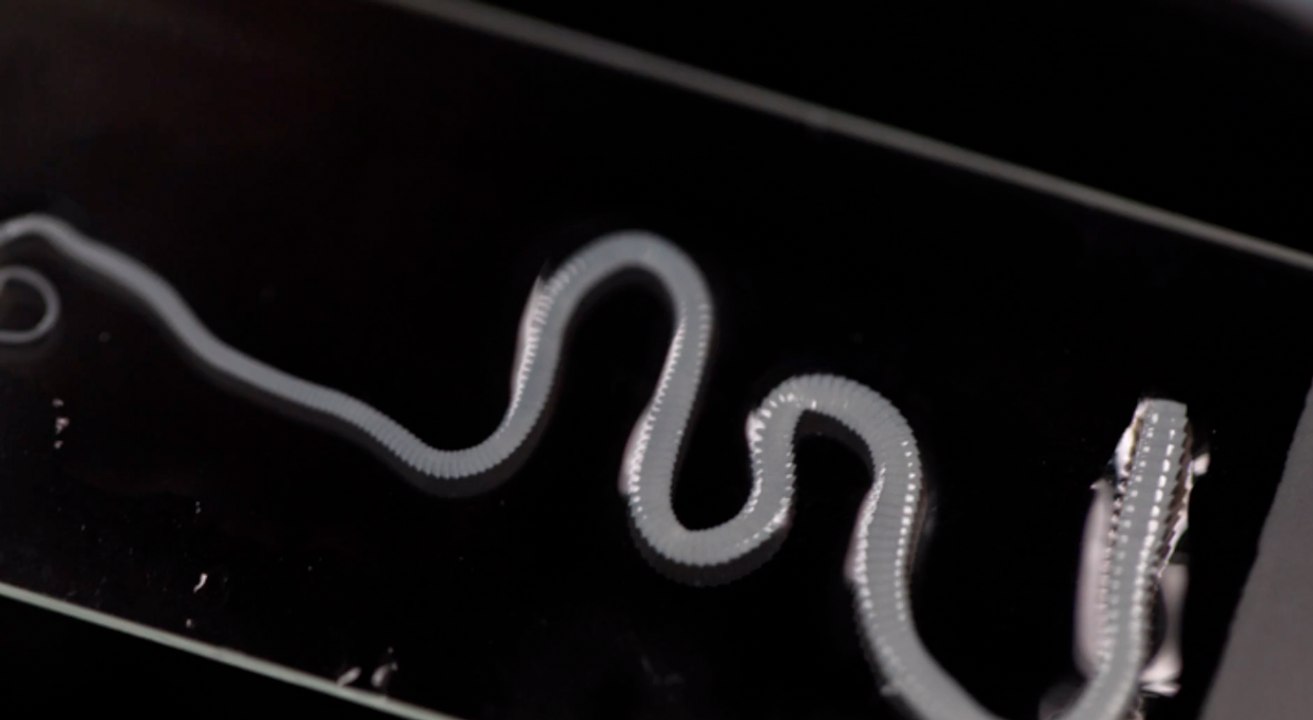 Riesiger wurm bei hirn-op entdeckt