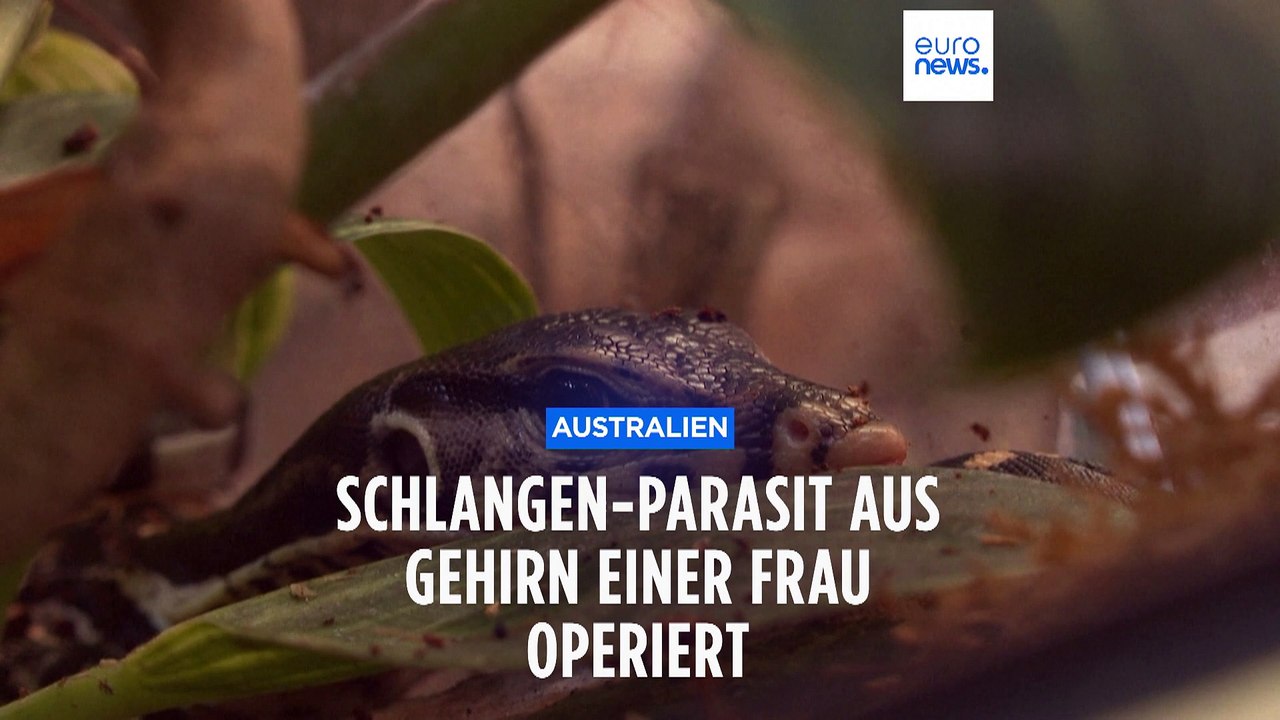 Wurm entfernt: Schlangen-Parasit aus Gehirn von 64-jähriger Frau operiert