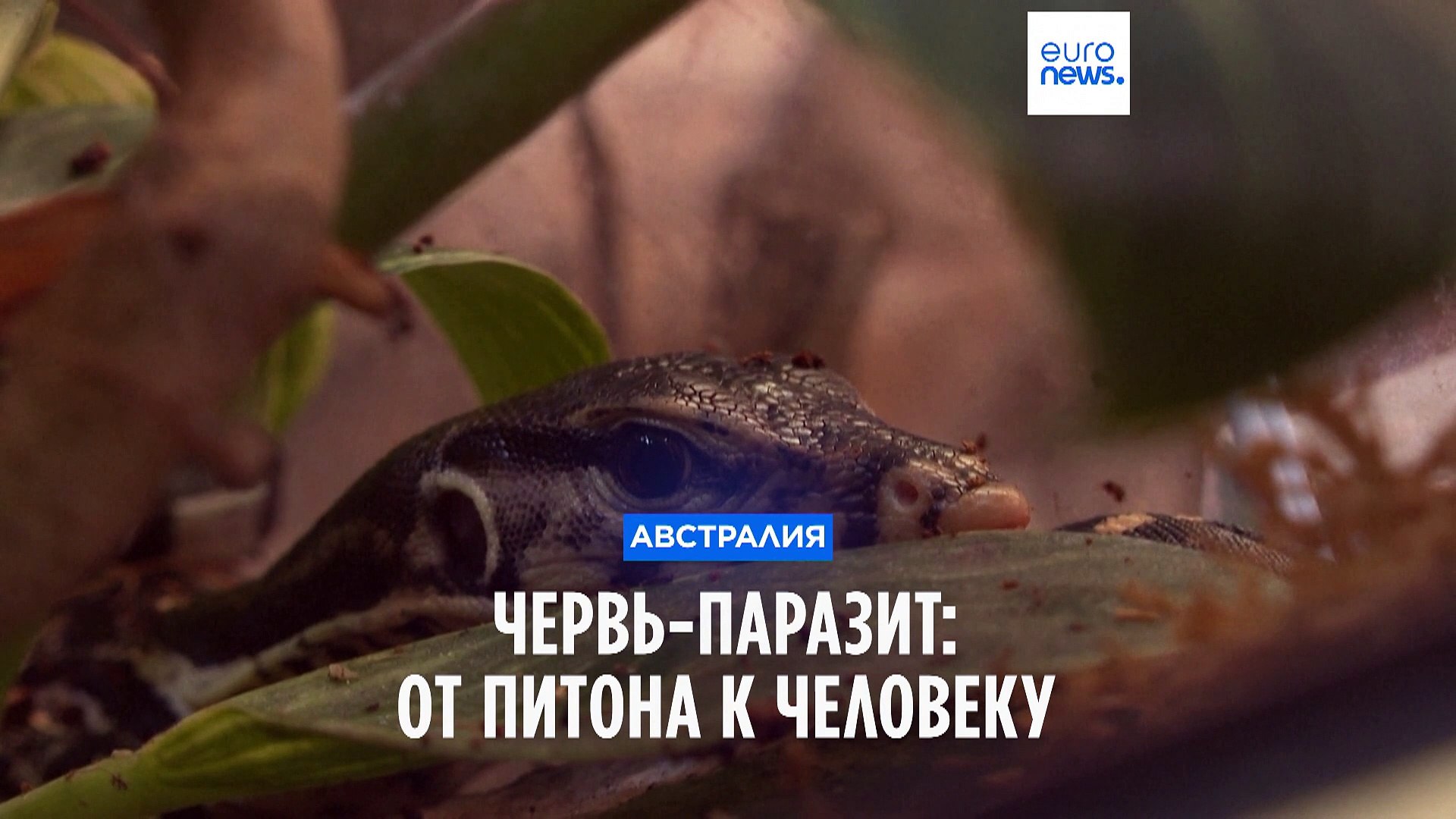 ⁣В Австралии в мозгу женщины нашли живого 8-сантиметрового червя