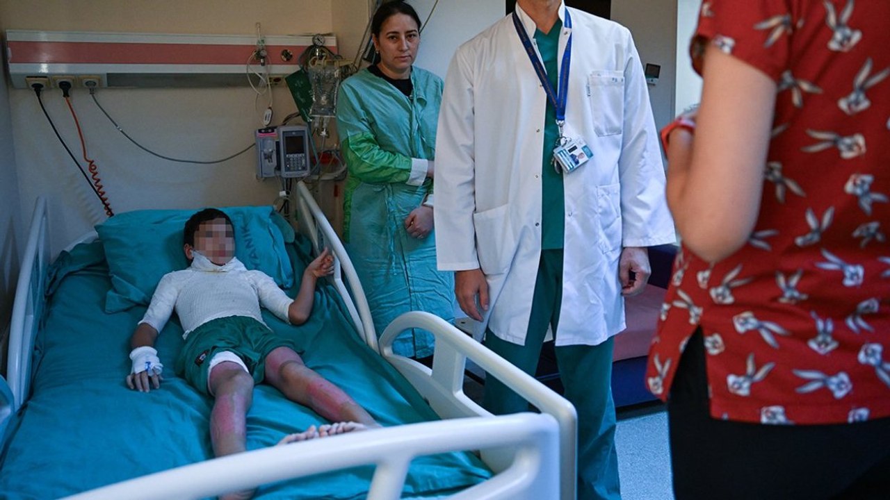 Sosyal medyada gördü, denedi, bu hale geldi