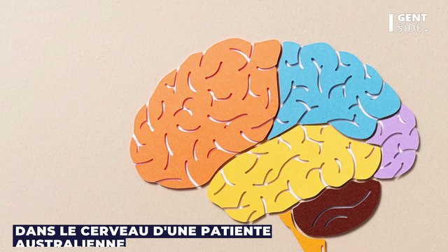 Victime de pertes de mémoire, des médecins découvrent un ver de 8cm vivant dans son cerveau