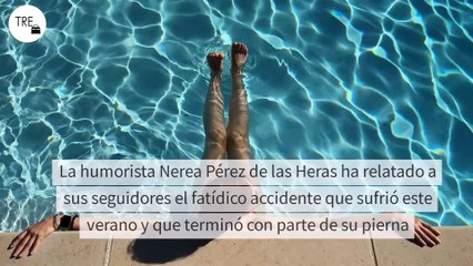 Amputan parte de la pierna de la humorista Nerea Pérez de las Heras tras sufrir este grave accidente en el mar