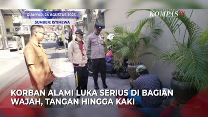 Satu Keluarga di Bali Digigit Anjing Rabies, Ada Luka Serius!