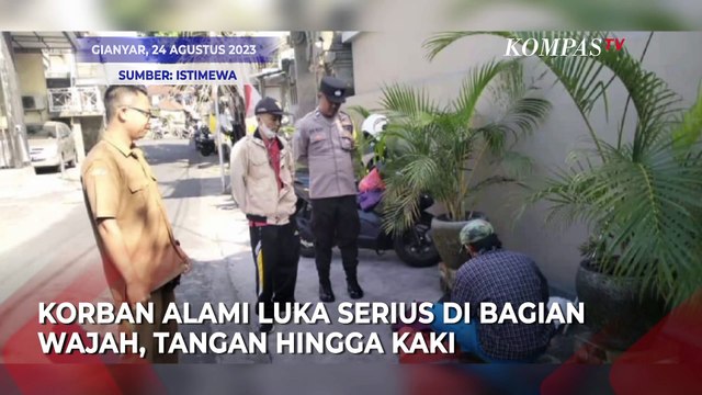 Satu Keluarga di Bali Digigit Anjing Rabies, Ada Luka Serius!