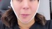 El mensaje concientizador de Luciana Milessi tras sufrir una parálisis facial en una operación estética