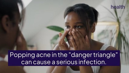 The 'Triangle of Death' Is Where You Should Never, Ever Pop A Pimple