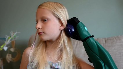 Girl, 7, can now brush her own hair as she becomes youngest in UK to be fitted with bionic arm