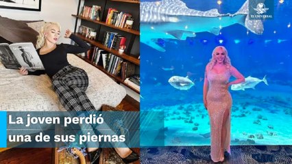 Vacaciones de terror: modelo se infecta de bacteria carnívora durante su viaje