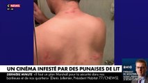 Regardez, en plein Paris, le cinéma UGC Bercy infesté par des centaines de puces de lits qui s'attaquent aux clients à travers les vêtements