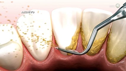 Salud bucal: más que sonrisas, una protección para el corazón y el cerebro, advierten expertos