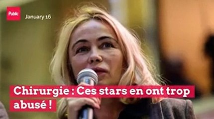 Chirurgie : Ces stars en ont trop abusé !