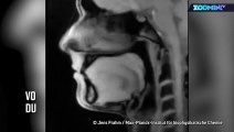 L'intérieur du corps humain filmé en IRM !