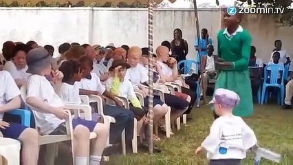 Le destin invivable des albinos d'Afrique