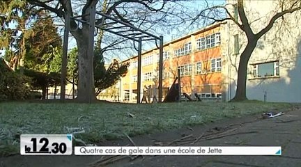 La gale refait surface