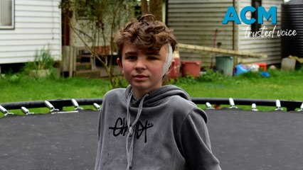 Teen survives brain bleed - September 4, 2023 - Warrnambool Standard
