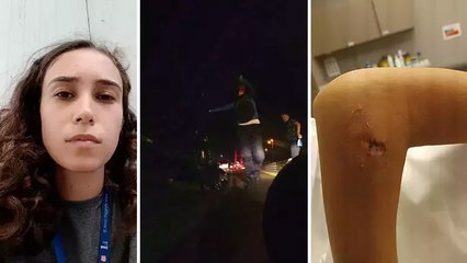 Akılalmaz kaza kamerada: Koşan adamla çarpıştı, aracın altında sürüklendi!