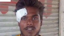 लखनऊ: बेखौफ दबंगों ने युवक को बेरहमी से पीटा,पीड़ित ने कार्रवाई की मांग