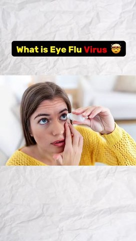 What is Eye flu virus?