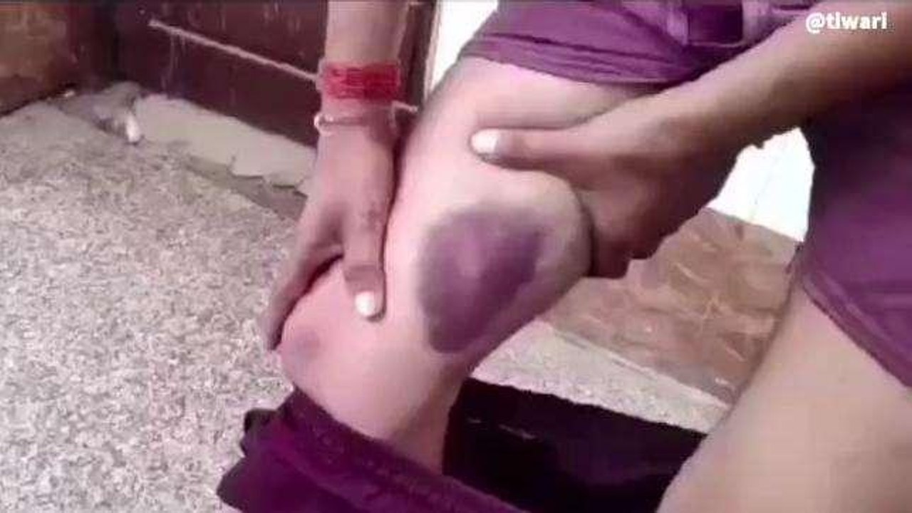 मुरैना: थाने में युवक के साथ हुई मारपीट, थाना प्रभारी और आरक्षक पर मामला दर्ज