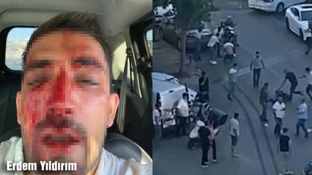 Trafikte sopa, muşta ve bıçaklı kavga kamerada