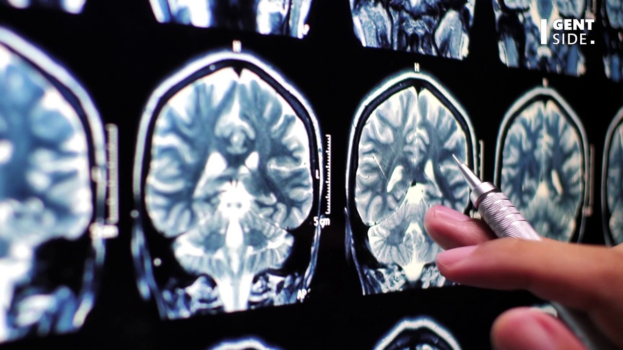 Scanner ou IRM : quelle est la différence ?