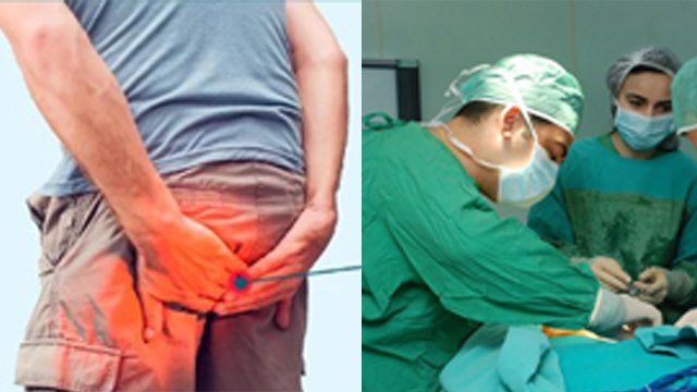 Piles Surgery Recovery Time | बवासीर सर्जरी रिकवरी टाइम | Bawasir Surgery Recovery Time | Boldsky