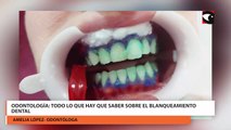 Odontología todo lo que hay que saber sobre el blanqueamiento dental  mp4