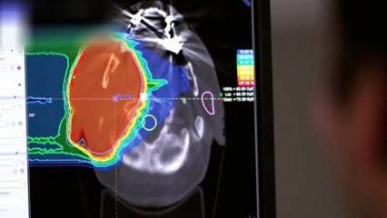 دراسة: زيادة الإصابات بالسرطان عالميا لدى من هم دون سن الخمسين