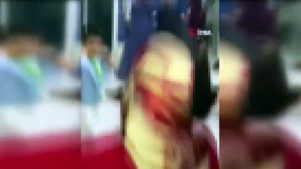 Düğününde 8 kurşunla yaralanan damadın son hali! Sağlık durumu iyiye gidiyor