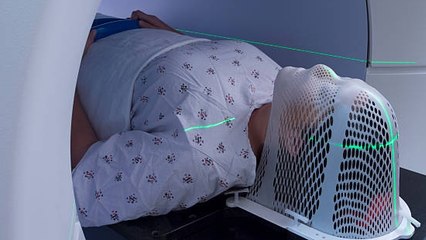 Aumentan Un 80% Los Casos De Cáncer En Menores De 50 Años