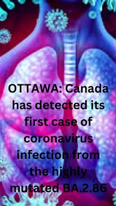 Canada detects first case of highly mutated coronavirus variant BA.2.86(1)