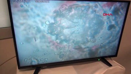 UZMANINDAN UYARI: UYUZ HASTASIYLA YAKIN TEMAS KURULMAMALI