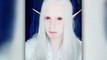 Man Spends Thousands On Plastic Surgery To Become An Elf