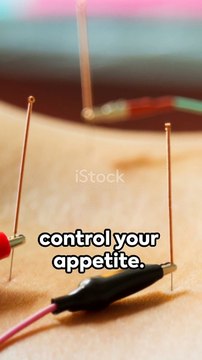 Unlocking the Secret to Appetite Control The Hidden Power of Acupuncture