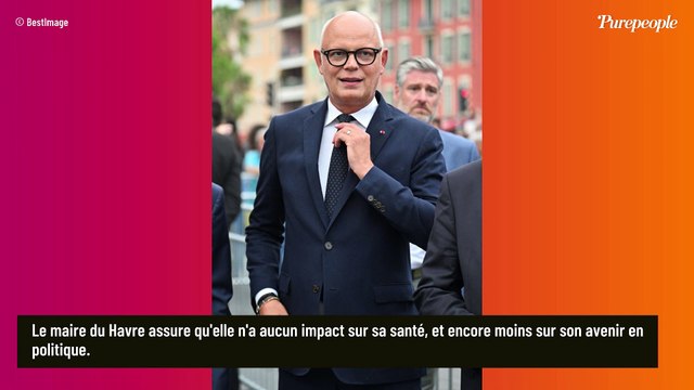 C'est les sourcils qui sont surprenants : Edouard Philippe franc sur sa métamorphose physique liée à sa maladie